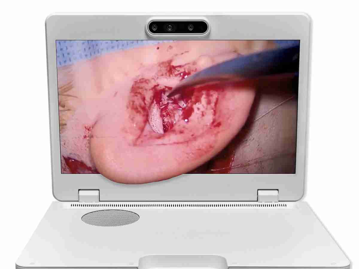 达擎之＂Heads-up 3D显微手术显示系统＂，，整合4K裸眼3D显示及眼球追踪系统，，，，具备快速追踪人眼移动位置功能，，减轻医师长时间维持固定姿势的负担，，，，让医师能有更宽广清晰的3D立体视野及更舒适的姿势来执行手术。。。